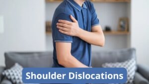 Shoulder Dislocations